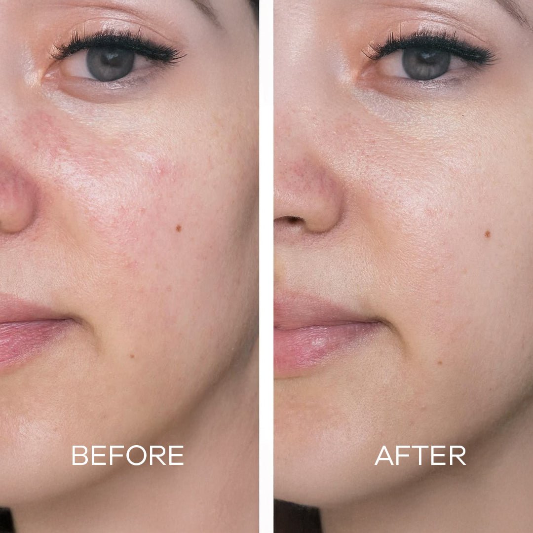 Lana Organic Oil Free Moisturizer