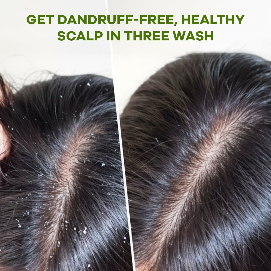Keratin Organic Anti Dandruff Shampoo